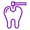 Composite Fillings