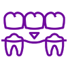 Dental Bridges
