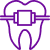 Free Orthodontic Consultation