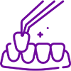 Dental Veneers